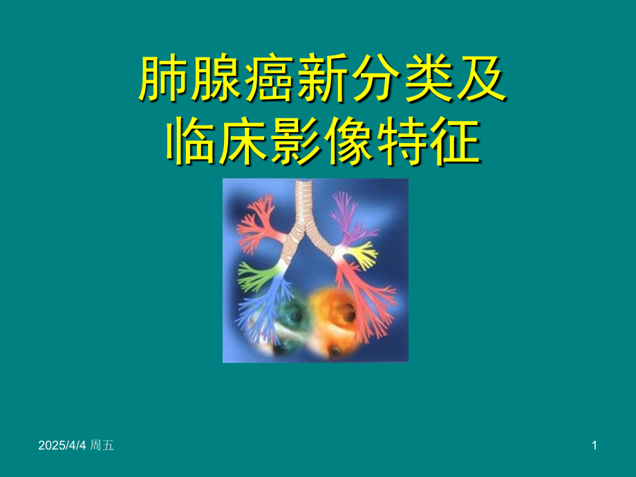 肺腺癌新分类及临床影像特征ppt课件.ppt_第1页