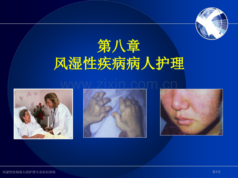 风湿性疾病病人的护理专业知识讲座.pptx_第1页