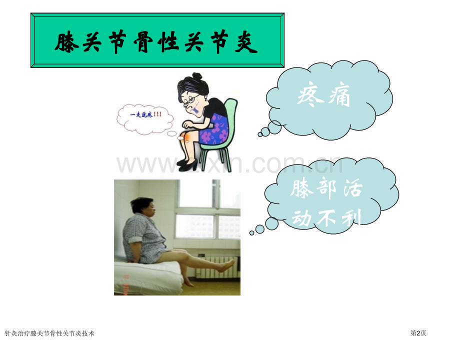 针灸治疗膝关节骨性关节炎技术专家讲座.pptx_第2页