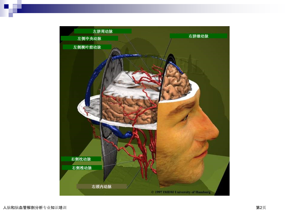 人脑和脑血管解剖分析专业知识培训专家讲座.pptx_第2页