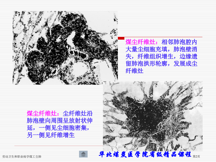 劳动卫生和职业病学煤工尘肺专家讲座.pptx_第2页