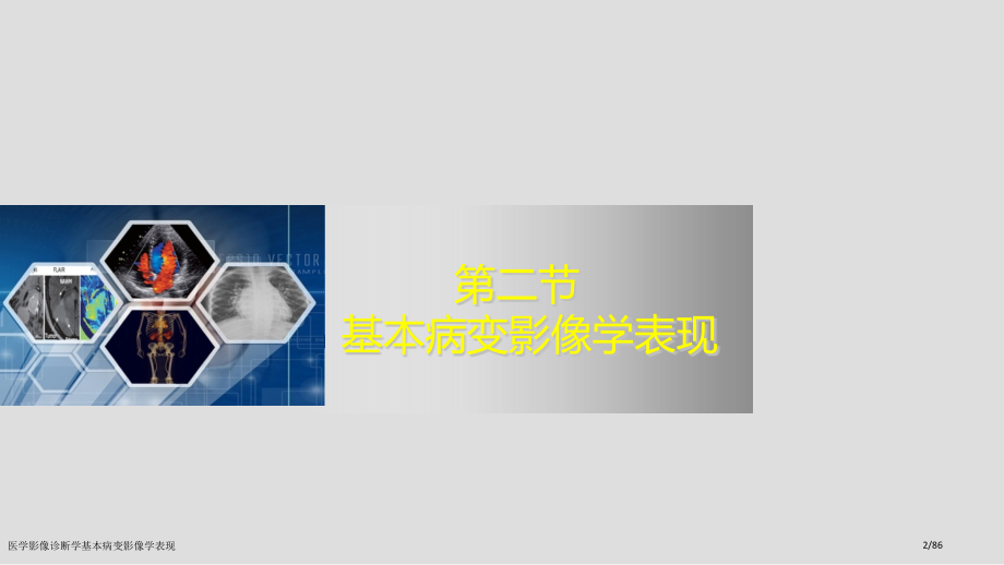 医学影像诊断学基本病变影像学表现.pptx_第2页