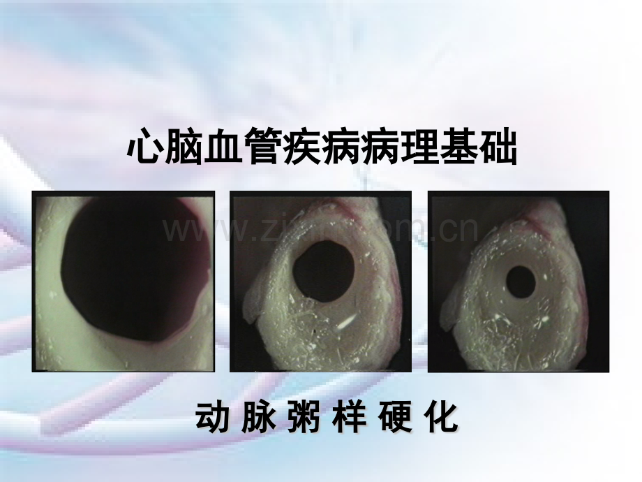 灵芝课件描述.pptx_第2页
