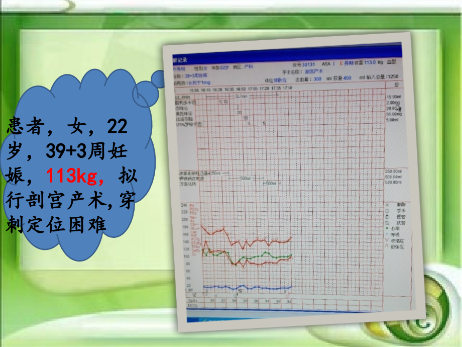 浅谈肥胖患者的麻醉处理.pptx_第1页