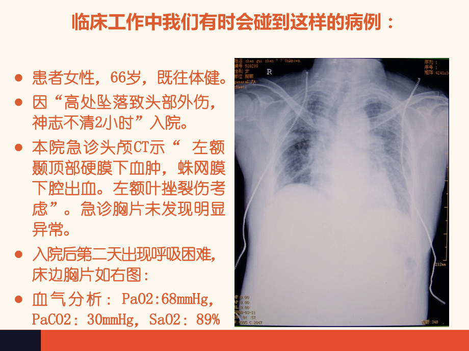顽固性低氧血症的诊治策略.pptx_第2页