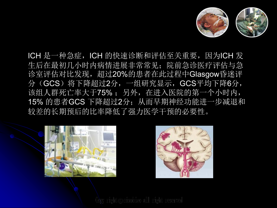 高血压脑出血新进展.pptx_第2页