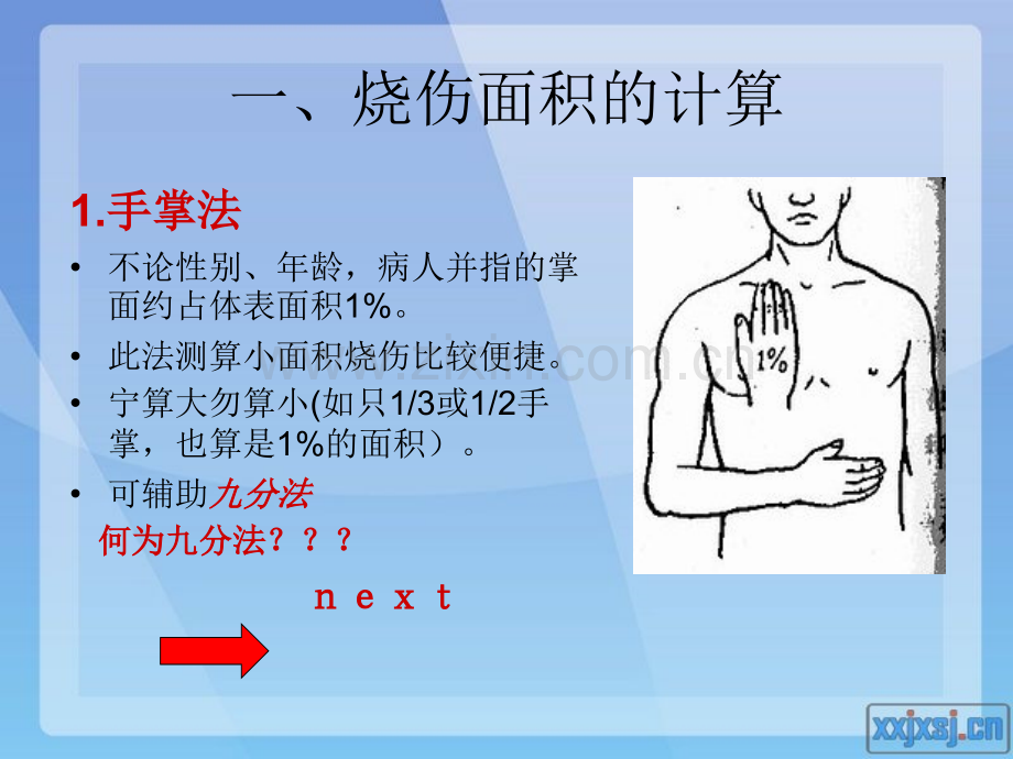 烧伤课件面积.pptx_第2页