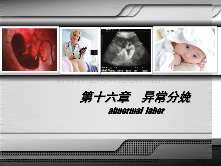 妇产科学胎位异常专家讲座.pptx_第1页
