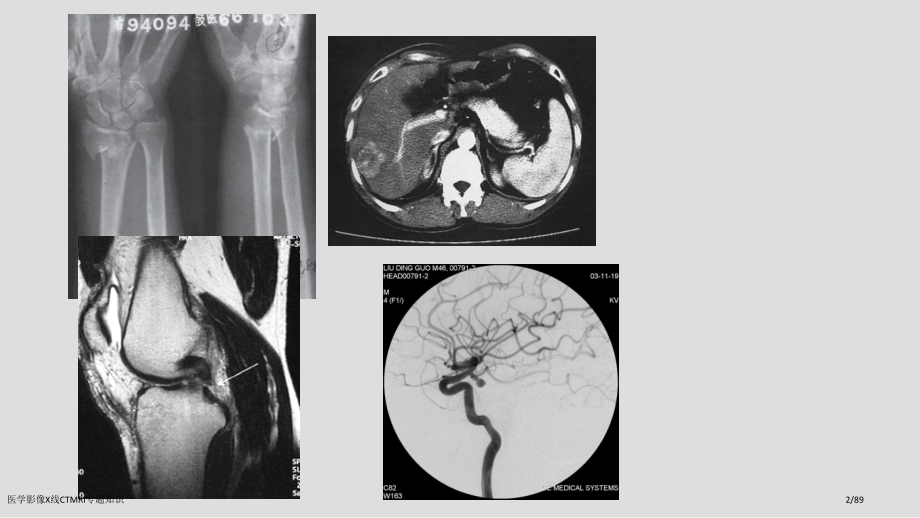 医学影像X线CTMRI专题知识.pptx_第2页