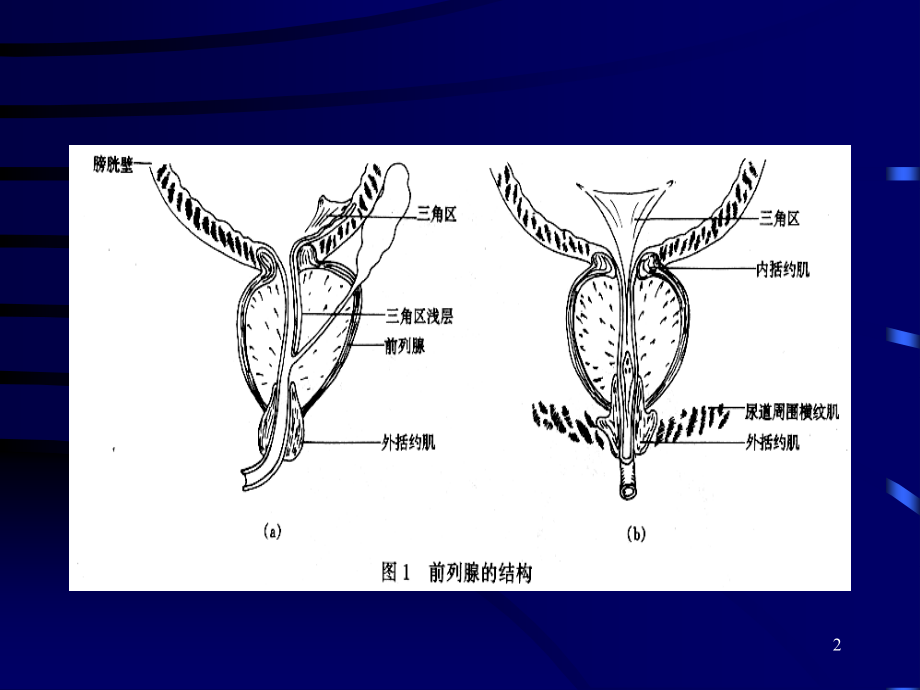 前列腺增生症的临床表现诊断和治疗.pptx_第2页