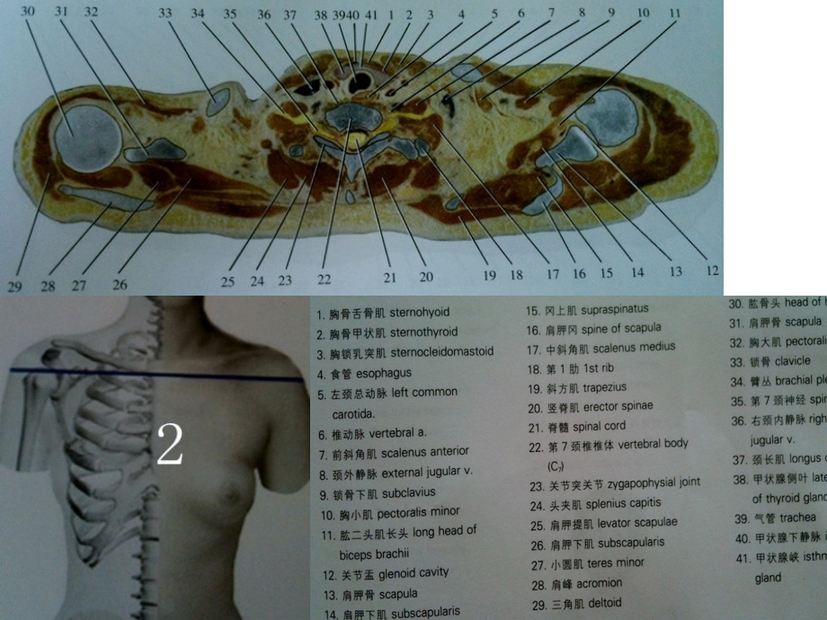 人体断面解剖图谱05-胸部水平断面.pptx_第2页