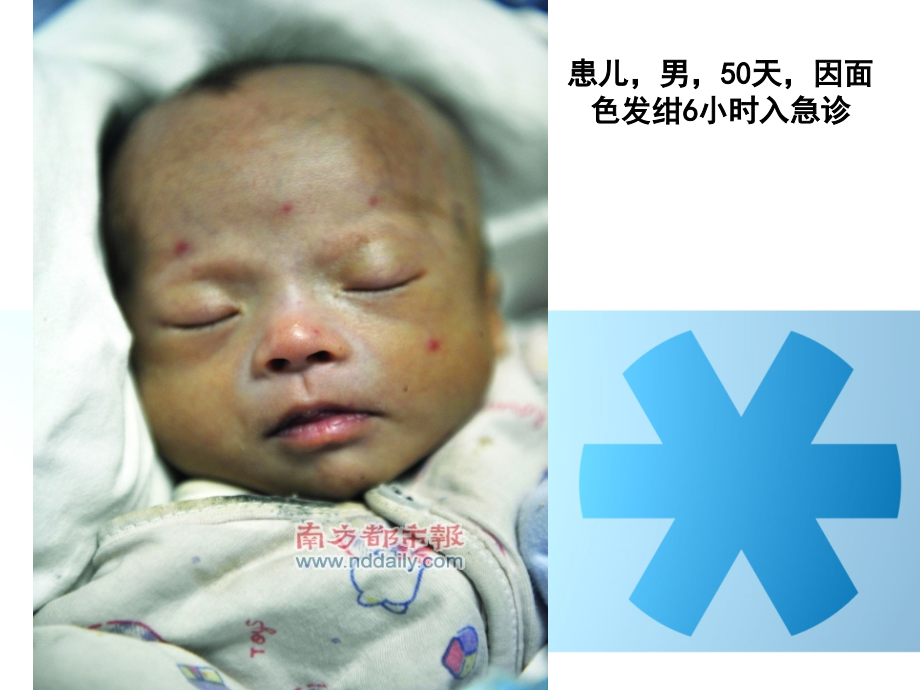 小儿急性中毒.pptx_第1页