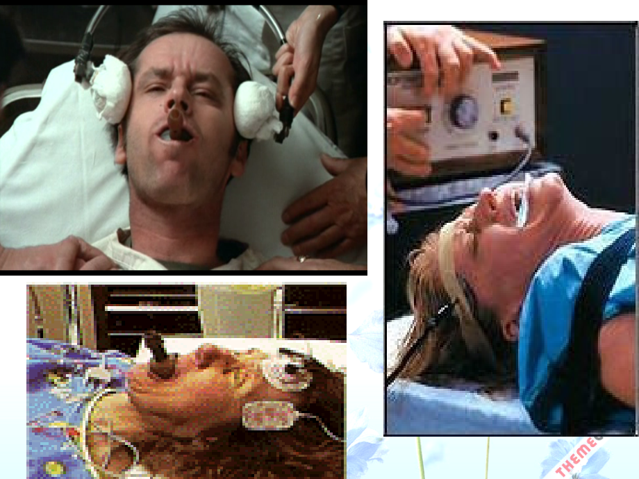 抑郁症治疗中的电抽搐治疗.pptx_第2页