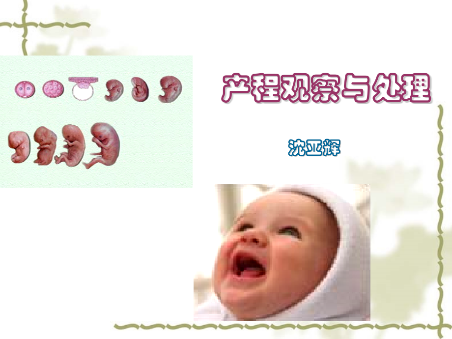 产程观察与处理.pptx_第1页