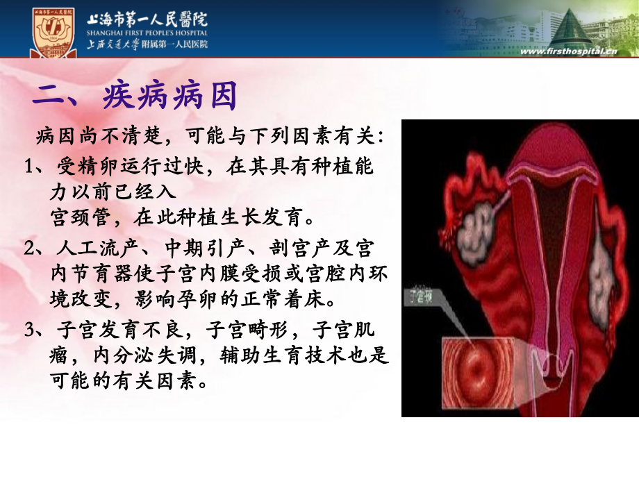 宫颈妊娠业务学习.pptx_第2页