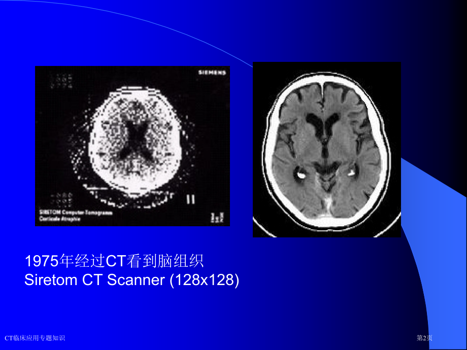 CT临床应用专题知识.pptx_第2页