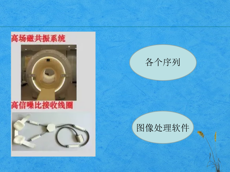 颅内动脉斑块高分辨成像.ppt_第2页