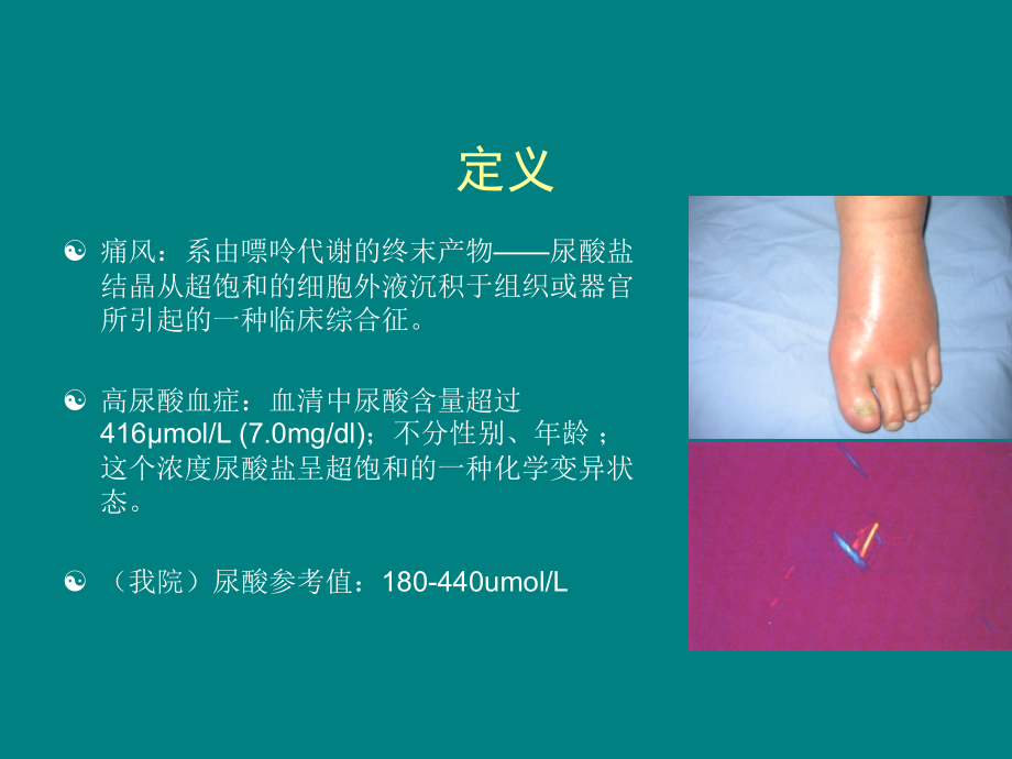 痛风性关节炎的诊治进展要点.ppt_第2页