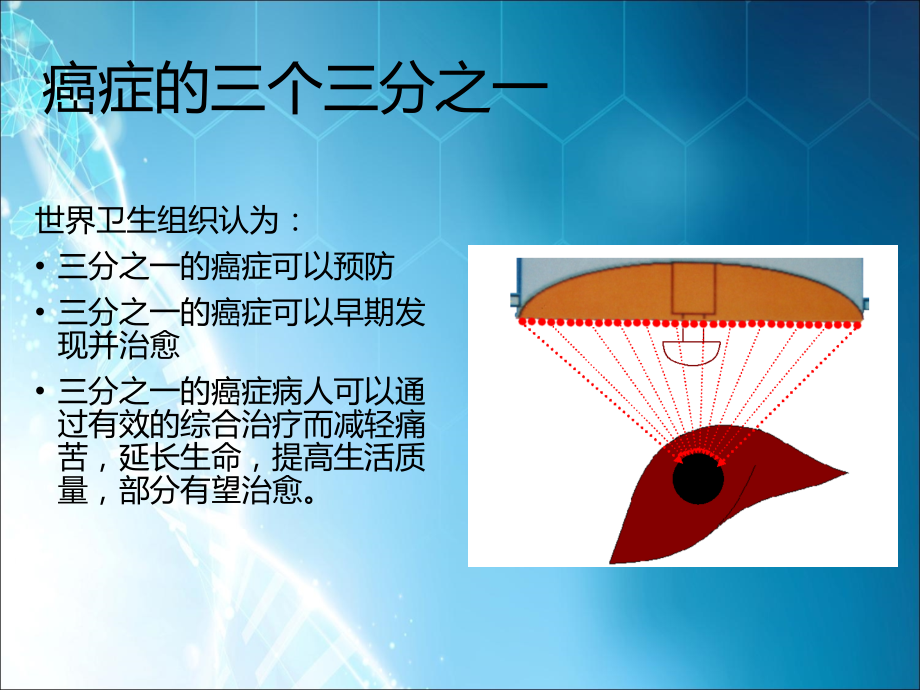 肿瘤防治知识-.ppt_第2页