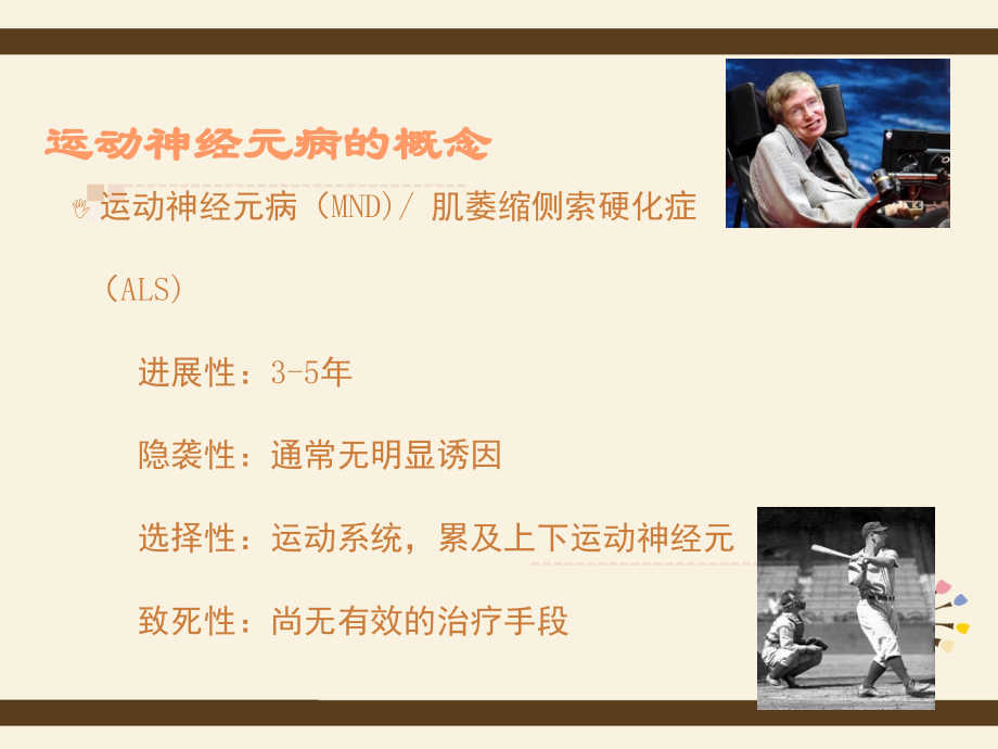 运动神经元病的特征表现.ppt_第2页