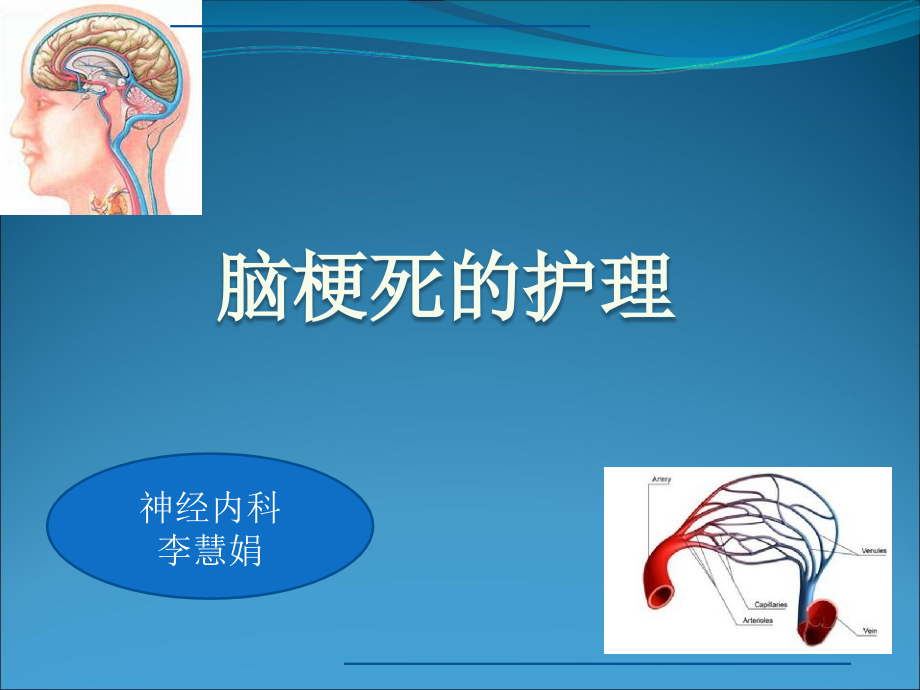 脑梗死的护理内容PPT.ppt_第1页