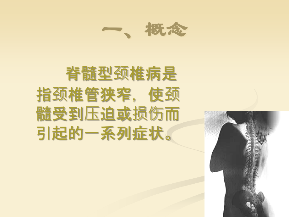 射频热凝靶点治疗脊髓型颈椎病.ppt_第2页