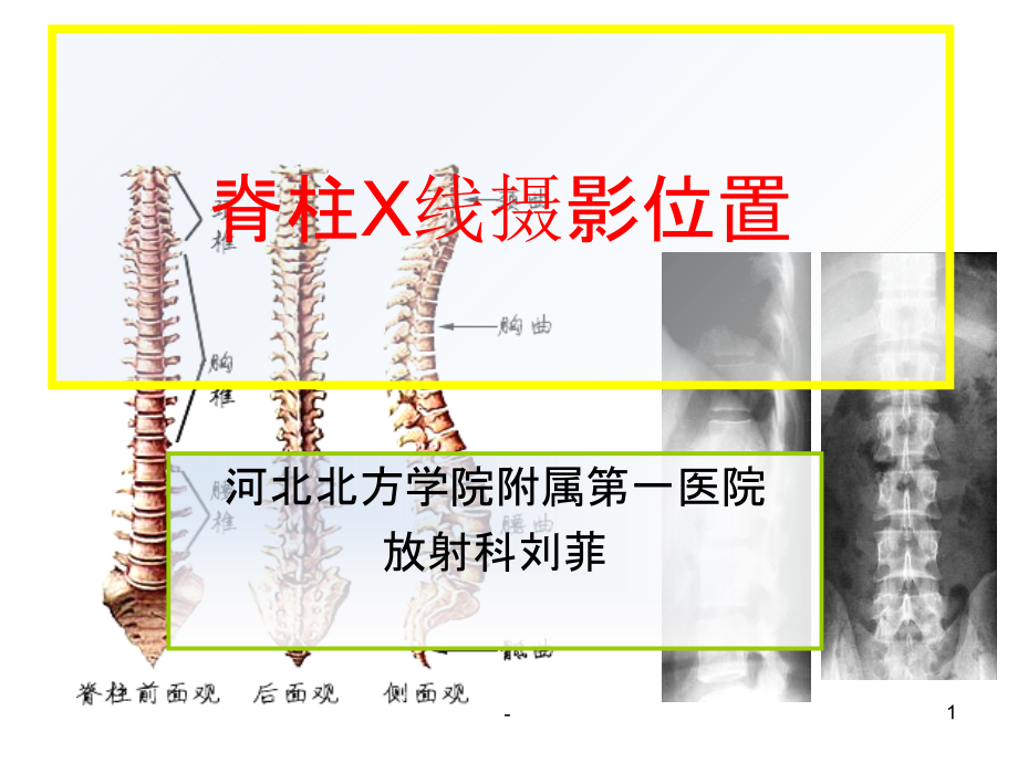 脊柱X线摄影技术.ppt_第1页
