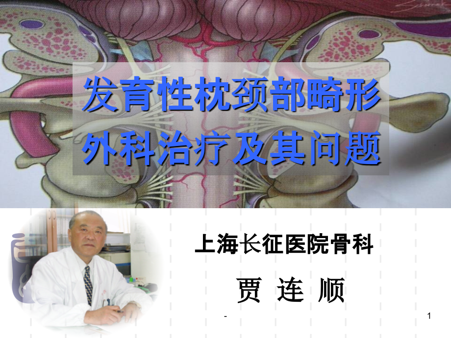 枕颈部发育畸形.ppt_第1页