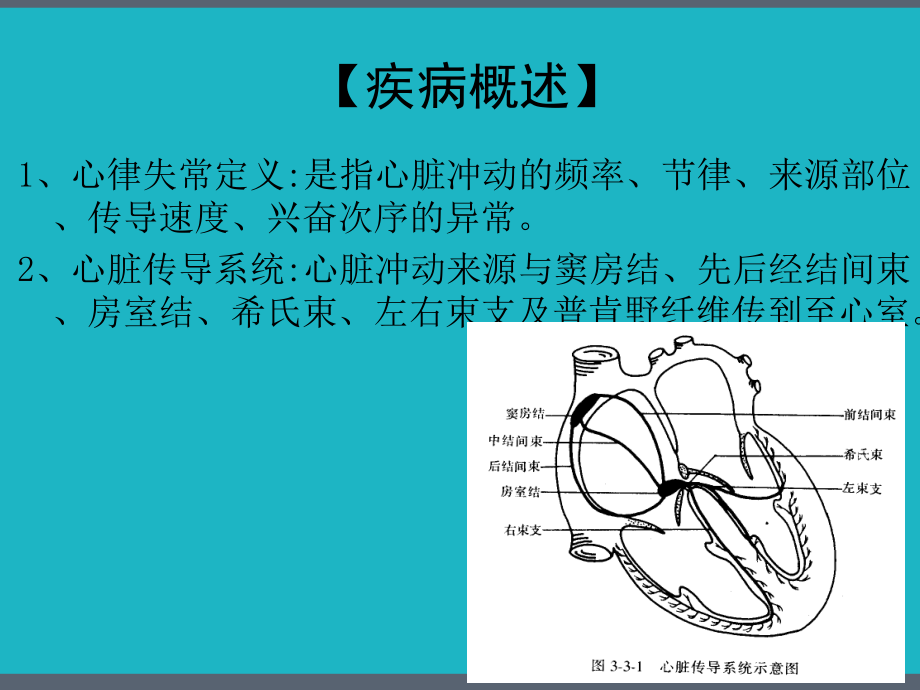 心律失常病人的护理查房.pptx_第2页