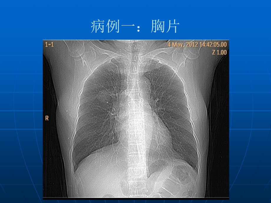 上海病例研讨会病例.ppt_第2页