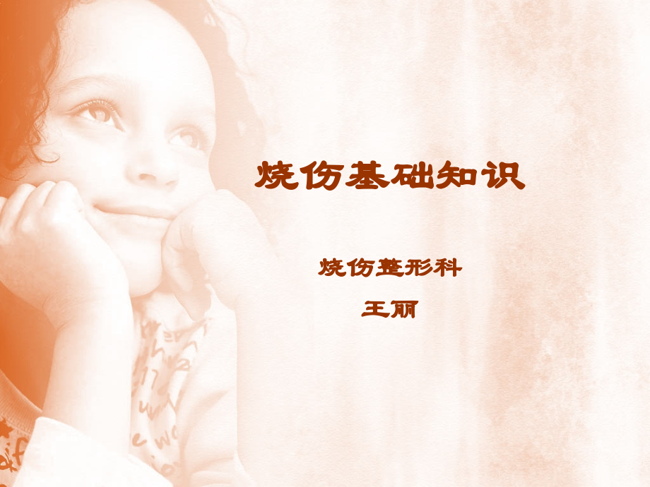 烧伤基础知识说课讲解.ppt_第1页