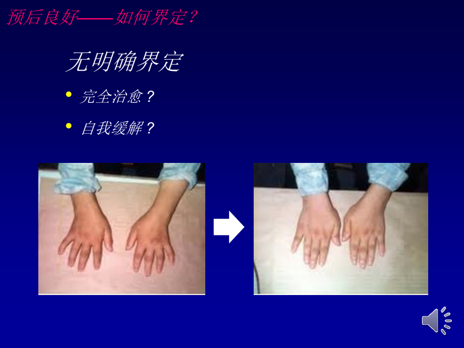 类风湿关节炎预后不良因素教学教材.ppt_第2页