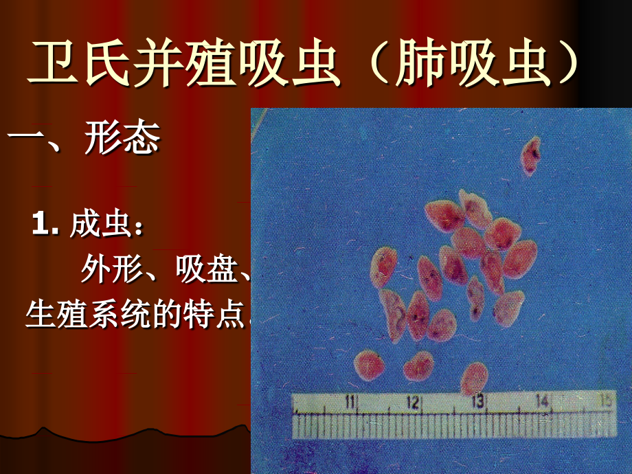 卫氏并殖吸虫(肺吸虫)教学提纲.ppt_第2页