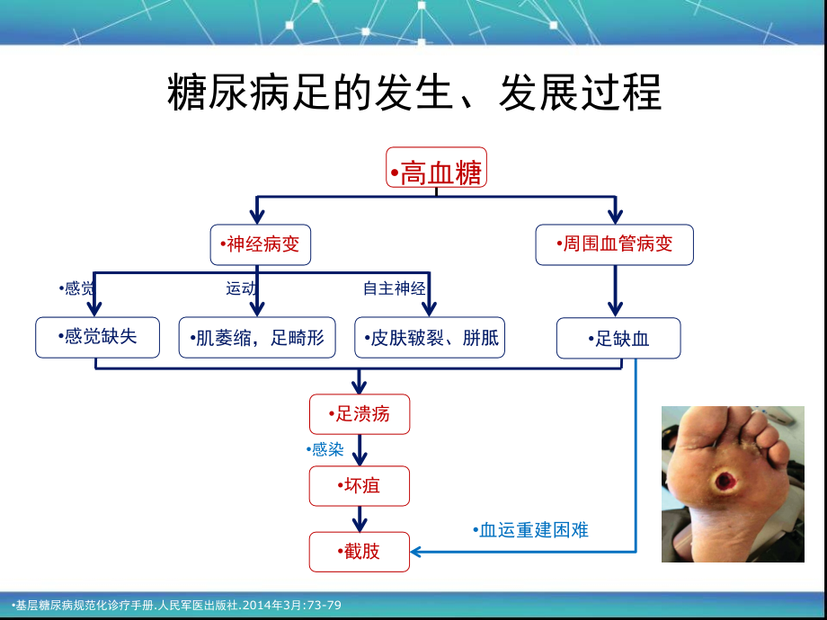版中国糖尿病足诊治指南讲解学习.ppt_第2页