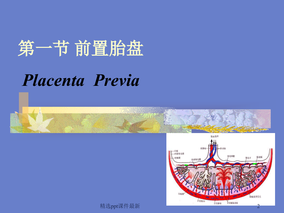前置胎盘课件课件课件.ppt_第2页