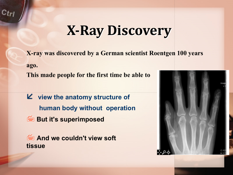 CT成像原理介绍(英文版)复习过程.ppt_第2页