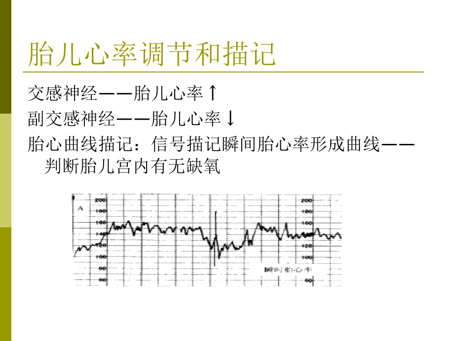 胎心监护及判读教学文案.ppt_第2页