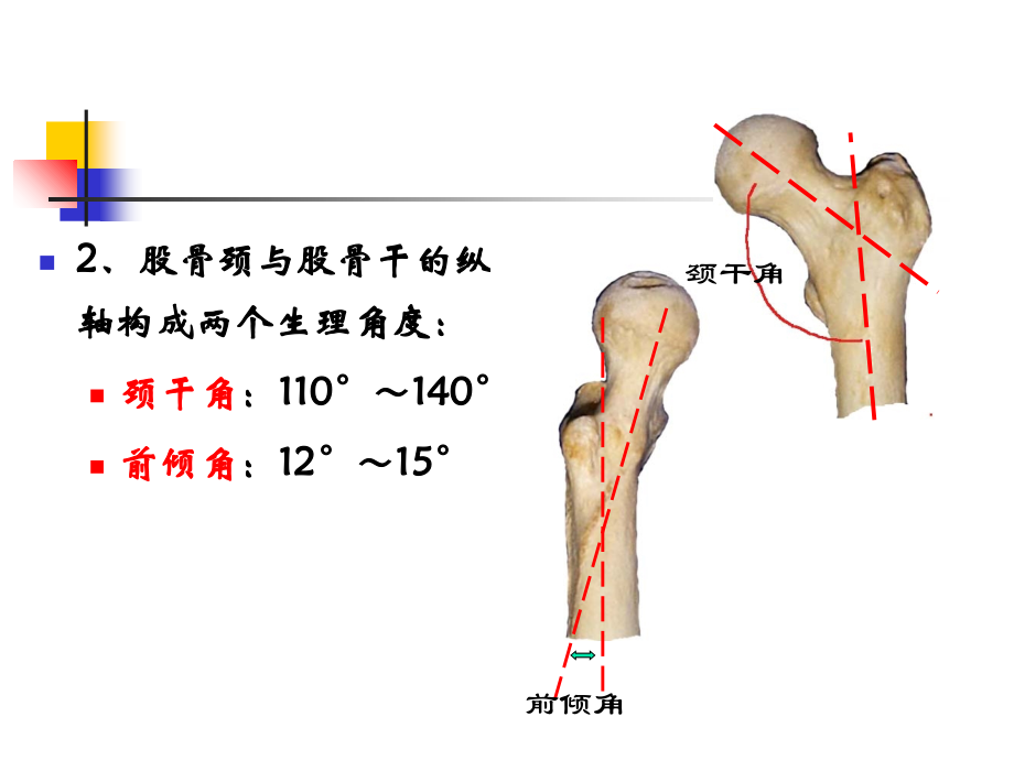 股骨颈骨折概述教学文案.ppt_第2页