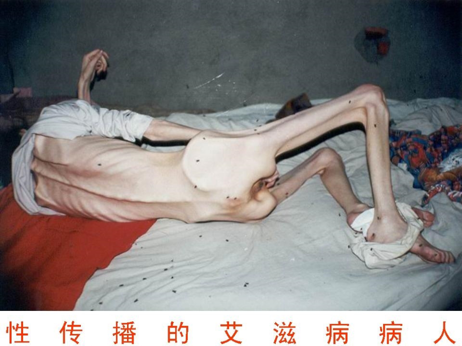 艾滋病课件PPT电子教案.ppt_第1页