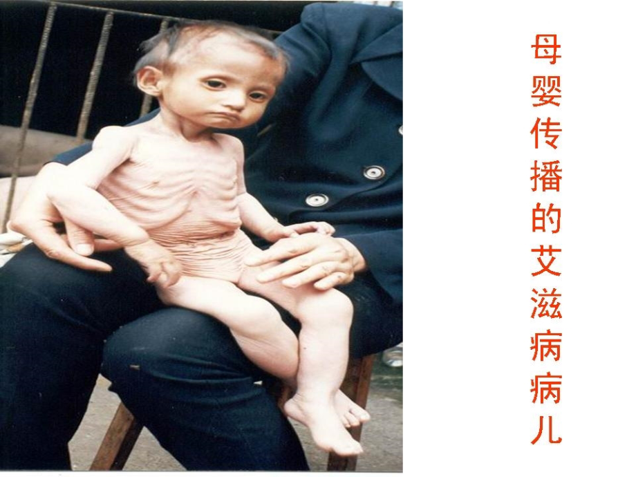 艾滋病课件PPT电子教案.ppt_第2页