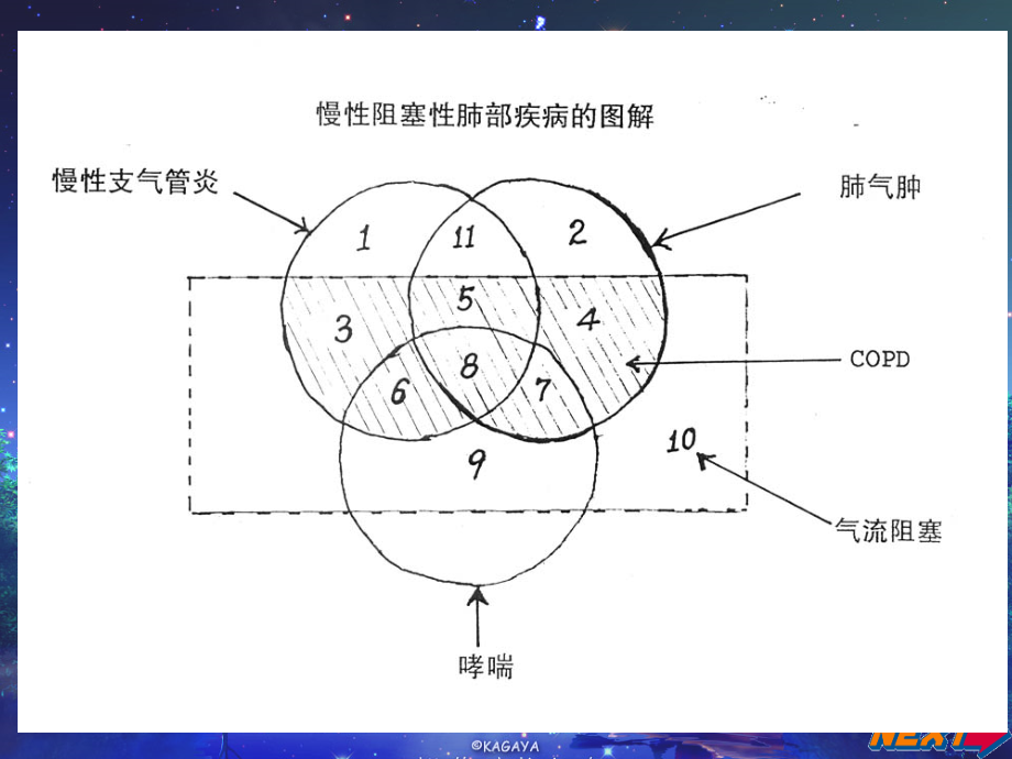 慢性阻塞性肺疾病中医治疗教学内容.ppt_第2页