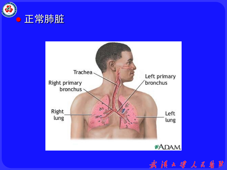 胸腔积液word版本.ppt_第2页
