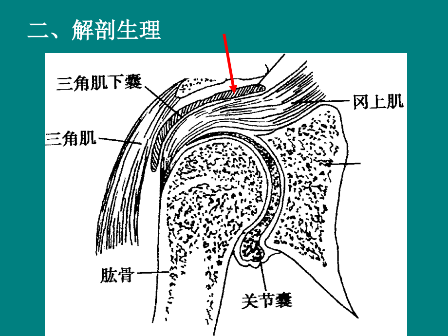 肩峰下滑囊炎学习资料.ppt_第2页
