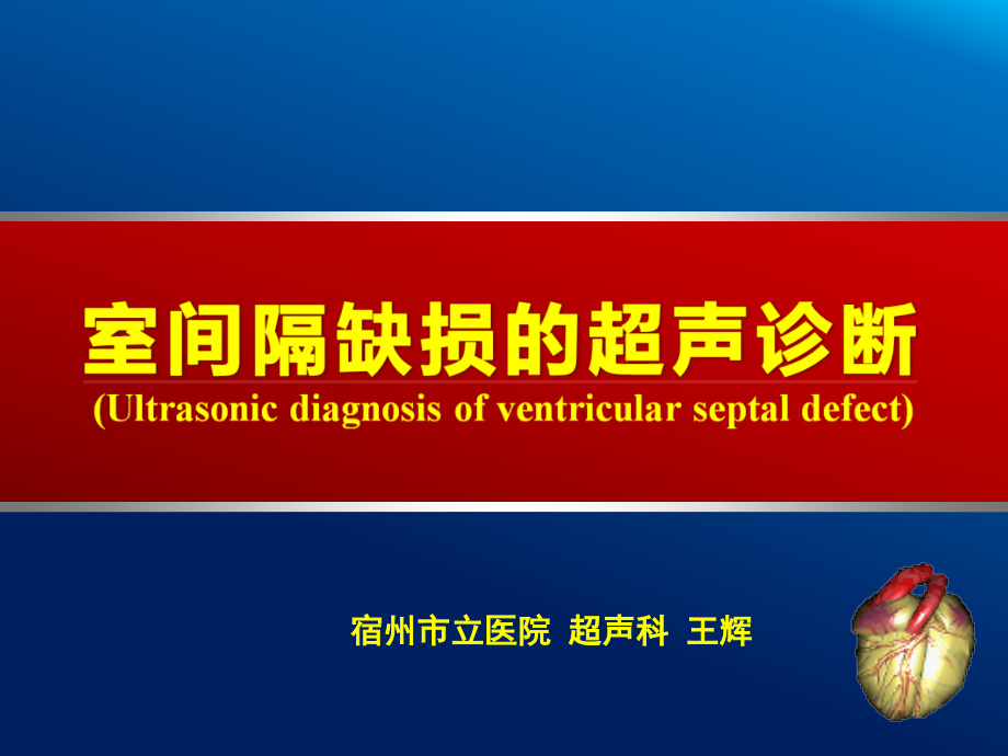 室间隔缺损超声诊断word版本.ppt_第1页