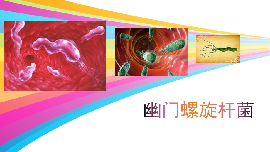 幽门螺旋杆菌感染ppt.ppt_第1页
