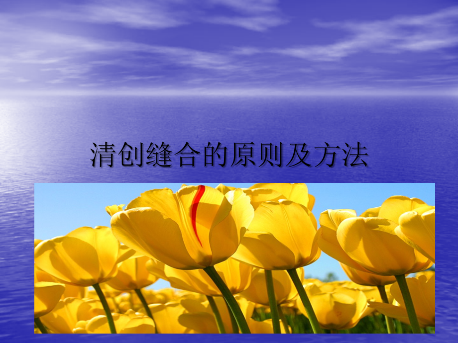 清创术的简单原则及方法PPT.ppt_第1页