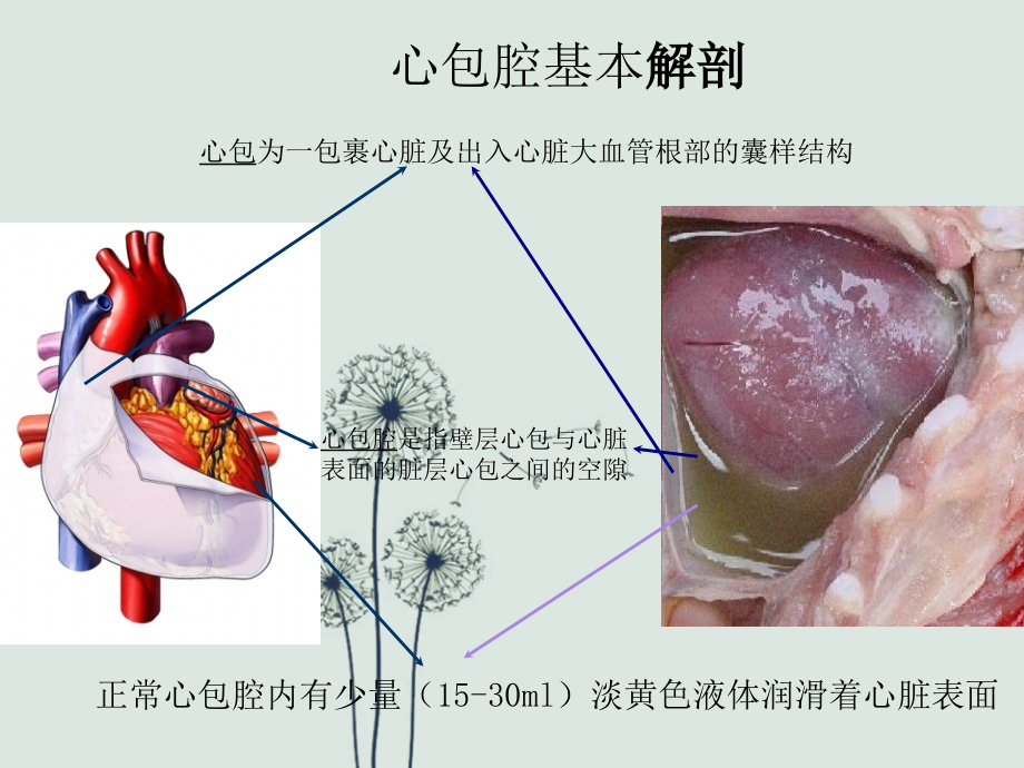 心包填塞正式版.ppt_第2页