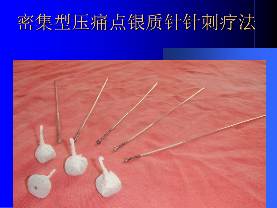 密集型压痛点银质针针刺疗法-.ppt_第1页