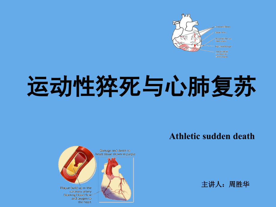 运动性猝死分析.ppt_第1页