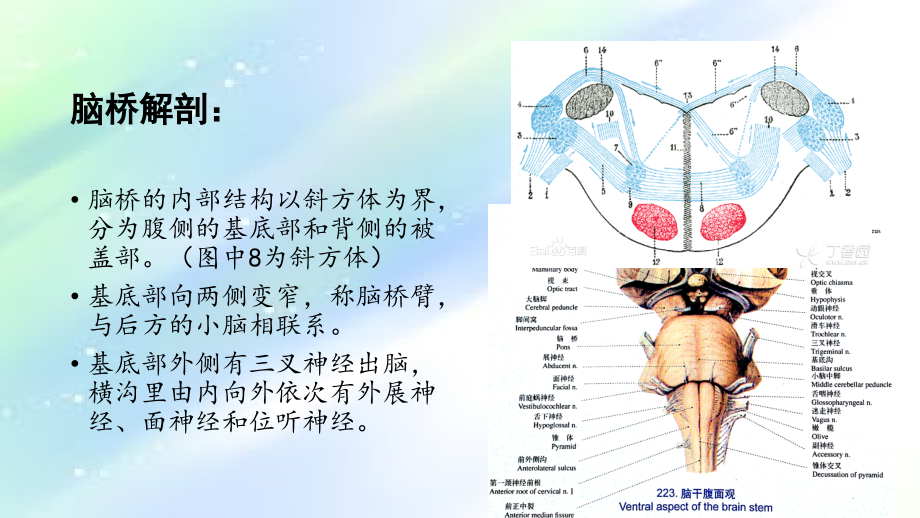 脑桥梗死&孤立性脑桥梗死.ppt_第2页